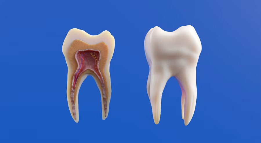 Periodontics at Ivory Dental Payyanur